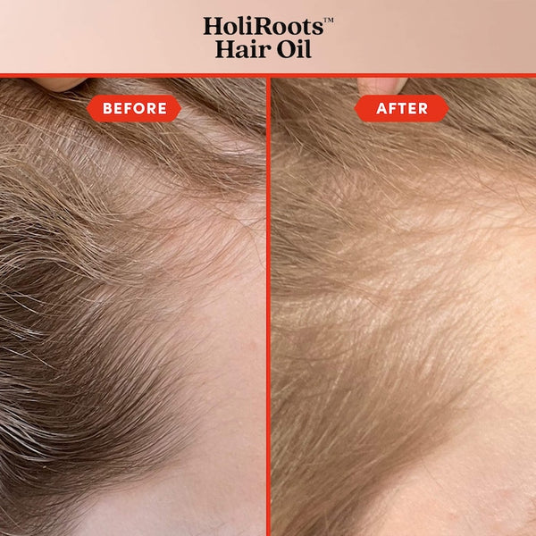 FABLE & MANE SET ESTIMULACIÓN Y CRECIMIENTO DE CABELLO PREVENTA