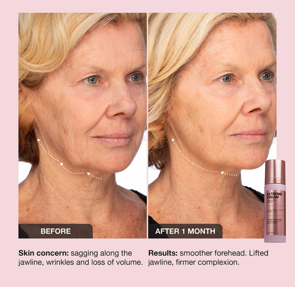 INBEAUTY EXTREME CREMA REAFIRMANTE EFECTO LIFTING FACIAL
